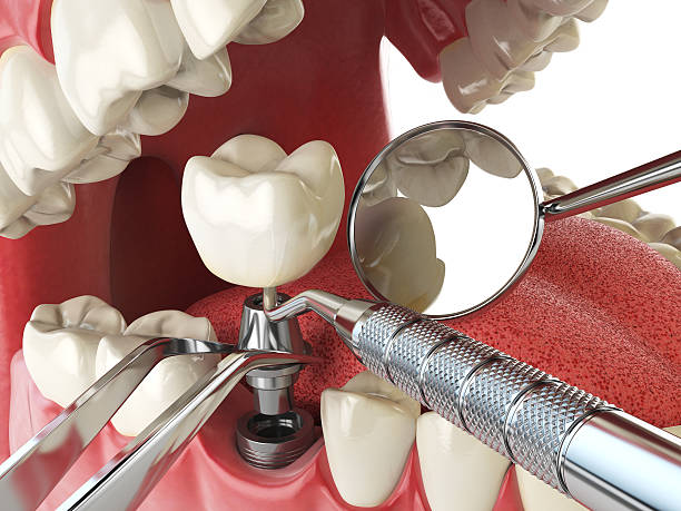 Best Cracked Tooth Emergency Dentist  in Dike, IA